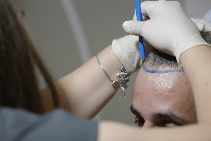 1740909381 113 photo Akira Injerto Capilar y Estética en Córdoba