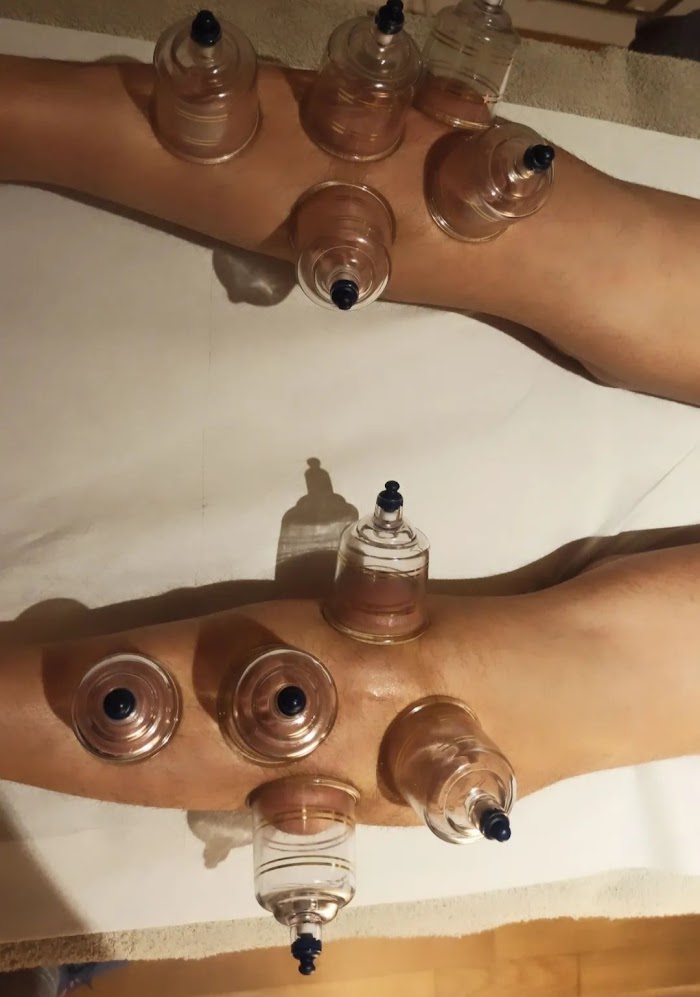 1744185550 935 photo Cristina Salas Quiroterapias