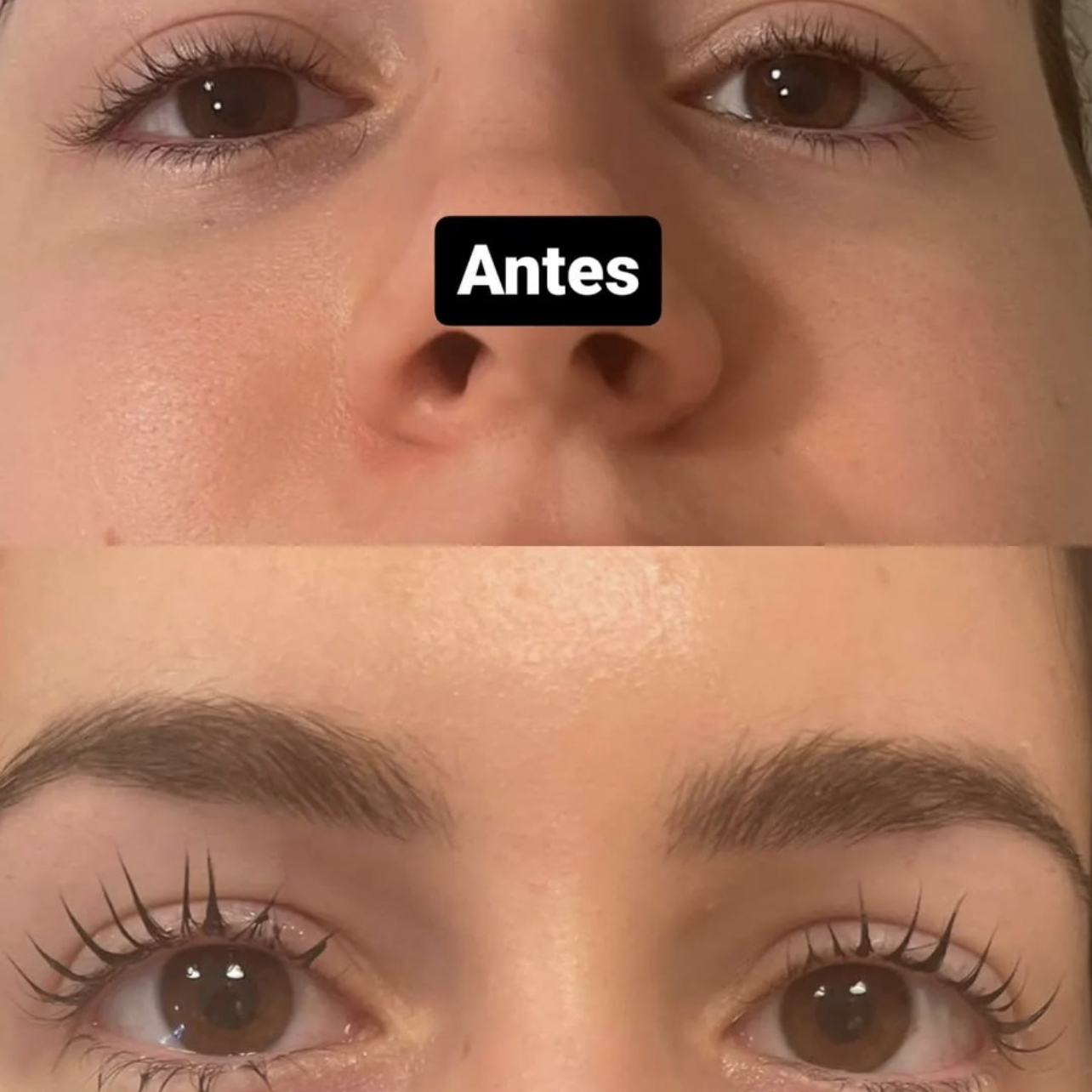 Masajes de drenaje linfatico